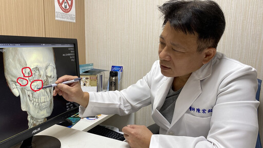 兩歲兒頭撞媽媽鼻骨竟斷了 醫呼籲:顏面受傷患者把握黃金治療期