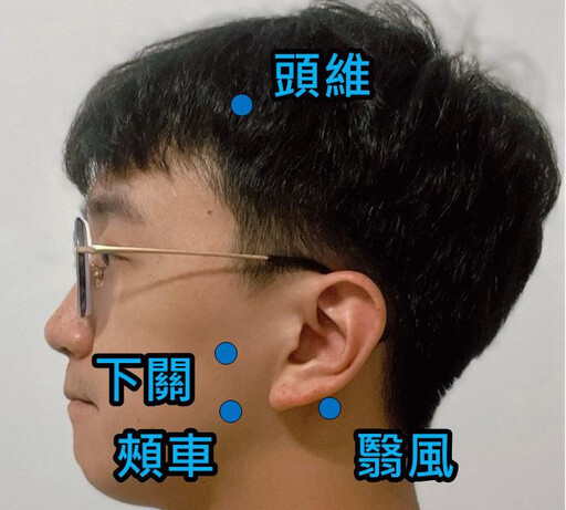 張嘴喀喀聲連帶耳鳴、肩頸僵硬 中醫針灸助患者重拾輕鬆
