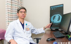 肺癌不只找癮君子！ 醫：5分鐘LDCT篩檢保命