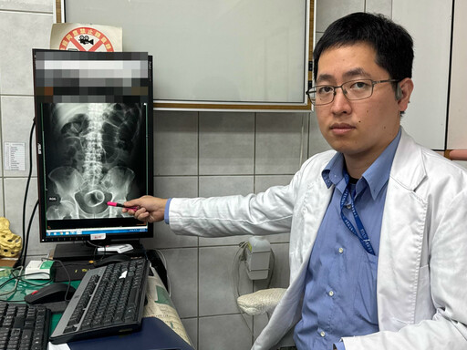 男3天無法嗯嗯 竟是瓷杯塞「菊花」惹禍！ 醫傻眼急開刀取出