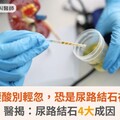 血尿、腰酸別輕忽，恐是尿路結石在搗蛋！醫揭：尿路結石4大成因