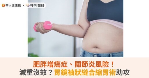 肥胖增癌症、關節炎風險！減重不見成效？胃鏡袖狀縫合縮胃術助攻