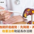 翻轉中晚期肝癌趨勢：先降期，再手術！栓塞治療助延長存活期