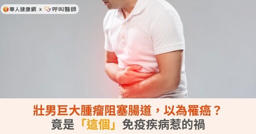 壯男巨大腫瘤阻塞腸道，以為罹癌？竟是「這個」免疫疾病惹的禍