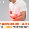 壯男巨大腫瘤阻塞腸道，以為罹癌？竟是「這個」免疫疾病惹的禍