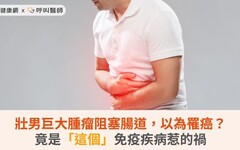 壯男巨大腫瘤阻塞腸道，以為罹癌？竟是「這個」免疫疾病惹的禍