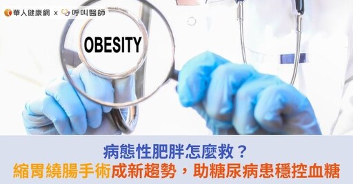 病態性肥胖怎麼救？縮胃繞腸手術成新趨勢，助糖尿病患穩控血糖