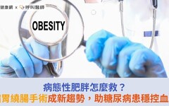 病態性肥胖怎麼救？縮胃繞腸手術成新趨勢，助糖尿病患穩控血糖