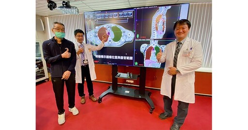 放射治療AI人工智慧器官圈註技術，2分鐘完成！精準勾畫減少副作用