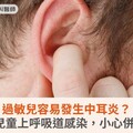 過敏兒容易發生中耳炎？3歲以下兒童上呼吸道感染，小心併發中耳炎