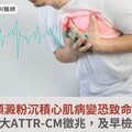 類澱粉沉積心肌病變恐致命！醫籲：5大ATTR-CM徵兆，及早檢查與治療