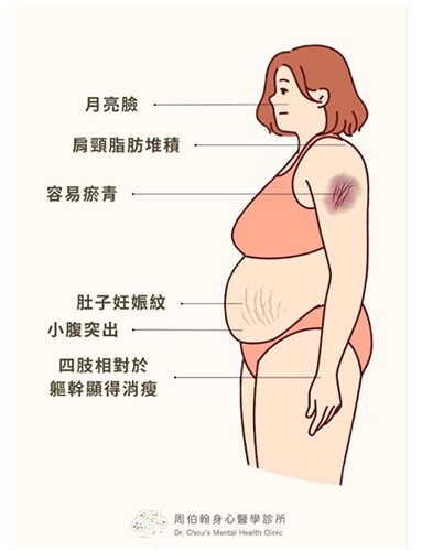 輕熟女變肥胖、憂鬱又失眠 …竟是罕見「庫欣氏症候群」作怪！