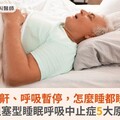 睡覺打鼾、呼吸暫停，怎麼睡都睡不飽？阻塞型睡眠呼吸中止症5大原因