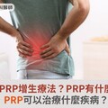 什麼是PRP增生療法？PRP有什麼功效？PRP可以治療什麼疾病？