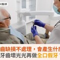 缺牙或牙齒缺損不處理，會產生什麼問題？等牙齒壞光光再做全口假牙？