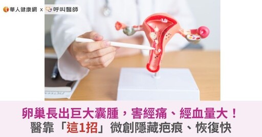 卵巢長出巨大囊腫，害經痛、經血量大！醫靠「這1招」微創隱藏疤痕、恢復快