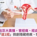 卵巢長出巨大囊腫，害經痛、經血量大！醫靠「這1招」微創隱藏疤痕、恢復快