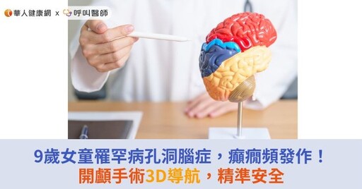 9歲女童罹罕病孔洞腦症，癲癇頻發！開顱手術3D導航，精準安全