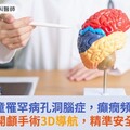 9歲女童罹罕病孔洞腦症，癲癇頻發！開顱手術3D導航，精準安全