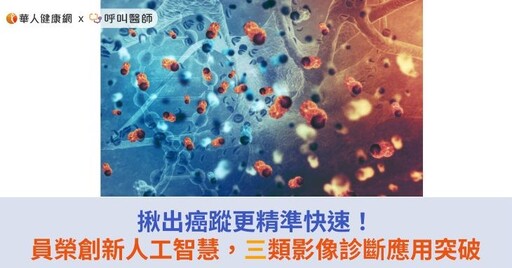 揪出癌蹤更精準快速！員榮創新人工智慧，三類影像診斷應用突破