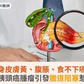 全身皮膚黃、腹脹、食不下嚥…竟是胰頭癌腫瘤引發膽道阻塞惹禍！