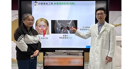 單側頭痛、眼睛痛，竟是鼻竇腫瘤惹禍！3D鼻竇導航手術解除大患