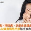 單側頭痛、眼睛痛，竟是鼻竇腫瘤惹禍！3D鼻竇導航手術解除大患