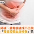 下腹疼痛、腰臀痠痛找不出原因？竟是「骨盆腔鬱血症候群」惹的禍