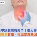 難治性甲狀腺癌有救了！臺大醫院研發NGS基因檢測套組，找出變異基因對症治療