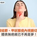 甲狀腺結節、甲狀腺癌內視鏡切除術，體表無疤痕已不再是夢！