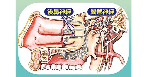 長期鼻過敏害下鼻甲肥厚！阻斷後鼻神經縮減下鼻甲，打鼾女戰勝鼻過敏