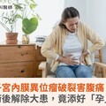 子宮內膜異位瘤破裂害腹痛！術後解除大患，竟添好「孕」