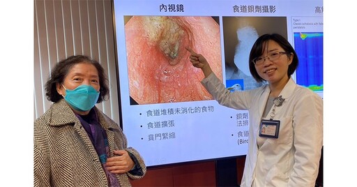 婦罹食道弛緩不能症，害吞嚥困難、暴瘦21公斤！POEM手術復原快速