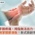 手腕疼痛、拇指無法出力…恐是拇指腕掌關節滑脫！新式微創手術恢復快