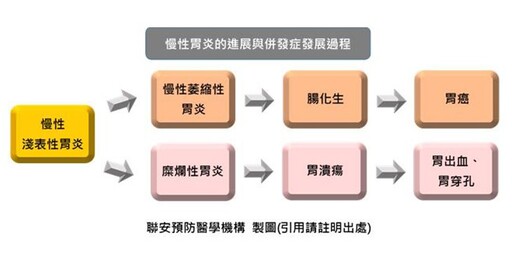 反覆胃痛別只吞胃藥，長期慢性胃炎恐惡化為胃癌！醫籲：檢查揪出胃炎致病原