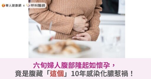 六旬婦人腹部隆起如懷孕，竟是腹藏「這個」感染化膿惹禍！