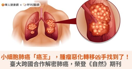 小細胞肺癌「癌王」，腫瘤惡化轉移凶手找到了！臺大跨國合作解密肺癌，榮登《自然》期刊