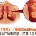 小細胞肺癌「癌王」，腫瘤惡化轉移凶手找到了！臺大跨國合作解密肺癌，榮登《自然》期刊