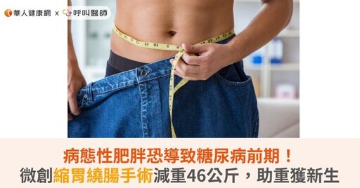 病態性肥胖恐導致糖尿病前期！微創縮胃繞腸手術減重46公斤，助重獲新生