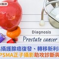 揪出攝護腺癌復發、轉移新利器：精準PSMA正子攝影助攻診斷與治療