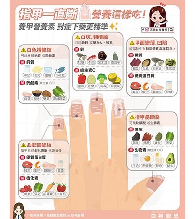 指甲斷裂、白線、凹陷，是什麼毛病？營養師揭：指甲5大症狀VS.缺少營養素