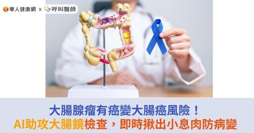 大腸腺瘤有癌變大腸癌風險！AI助攻大腸鏡檢查，即時揪出小息肉防病變