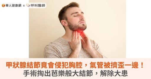 甲狀腺結節竟會侵犯胸腔，氣管被擠歪一邊！手術掏出芭樂般大結節，解除大患