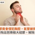 甲狀腺結節竟會侵犯胸腔，氣管被擠歪一邊！手術掏出芭樂般大結節，解除大患
