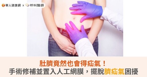 肚臍竟然也會得疝氣！手術修補並置入人工網膜，擺脫臍疝氣困擾