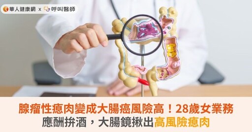 腺瘤性瘜肉變成大腸癌風險高！28歲女業務應酬拚酒，大腸鏡揪出高風險瘜肉