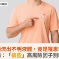 男乳頭流出不明液體，竟是罹患乳癌！醫揭：「這些」高風險因子別輕忽