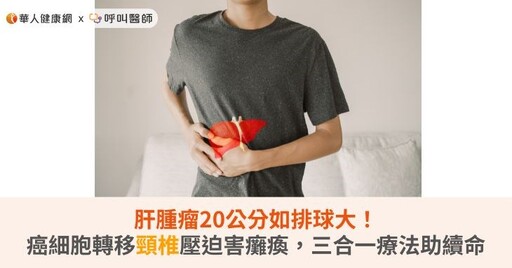 肝腫瘤20公分如排球大！癌細胞轉移頸椎壓迫害癱瘓，三合一療法助續命