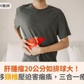 肝腫瘤20公分如排球大！癌細胞轉移頸椎壓迫害癱瘓，三合一療法助續命