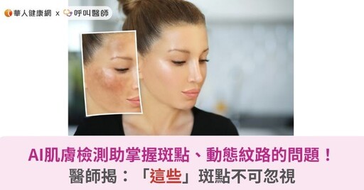 AI肌膚檢測幫妳掌握斑點、動態紋路的問題！醫師揭：「這些」斑點不可忽視